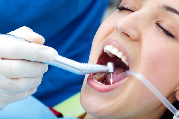 עקירת שיניים – הוראות להחלמה מיטבית